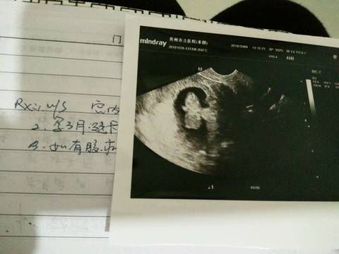 journal_insert_pic_1108870707