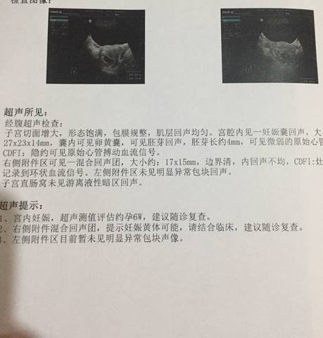 journal_insert_pic_1109468095