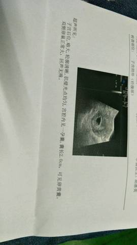 journal_insert_pic_1109190986