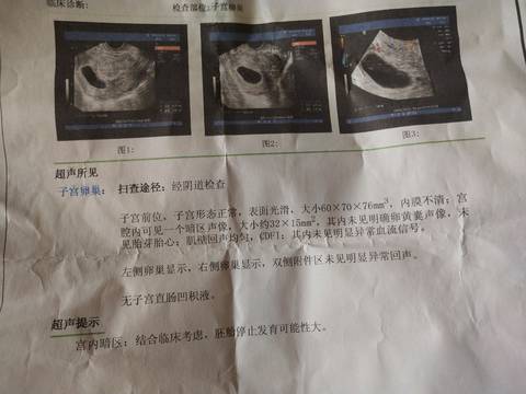 journal_insert_pic_1109722142