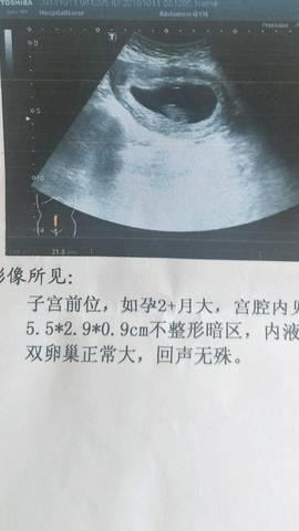 journal_insert_pic_1110332647