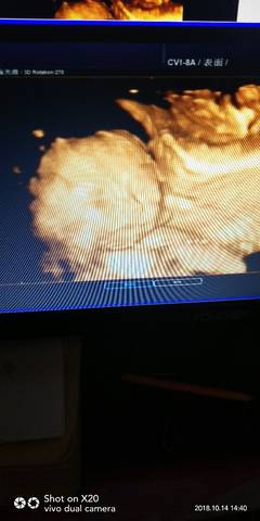 journal_insert_pic_1111688497