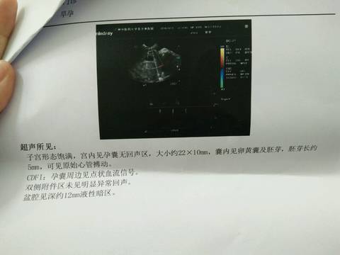 journal_insert_pic_1111434462