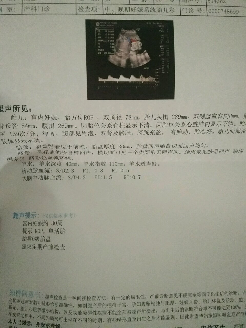 附图，侧脑室宽的宝妈可以放轻松，宝宝很坚强的！
