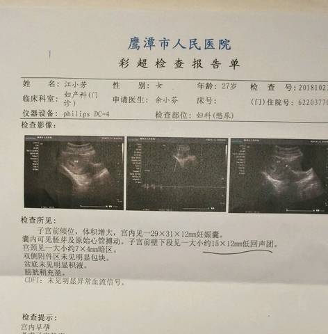 journal_insert_pic_1117083101