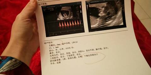 journal_insert_pic_1118878331