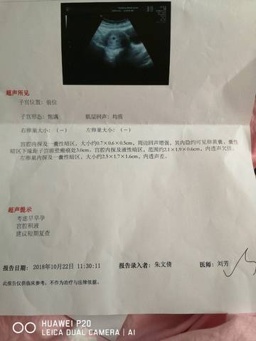 journal_insert_pic_1118858193