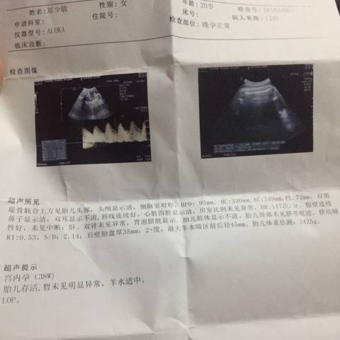 journal_insert_pic_1121087458
