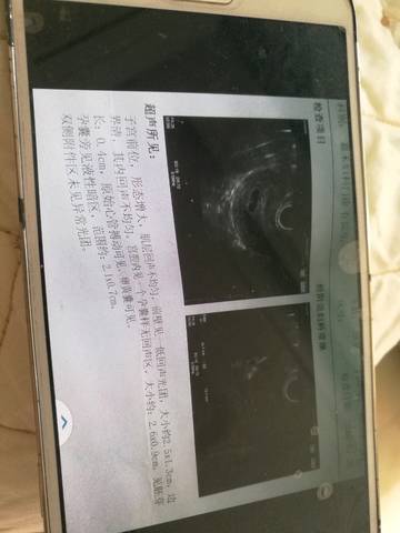 journal_insert_pic_1123318967