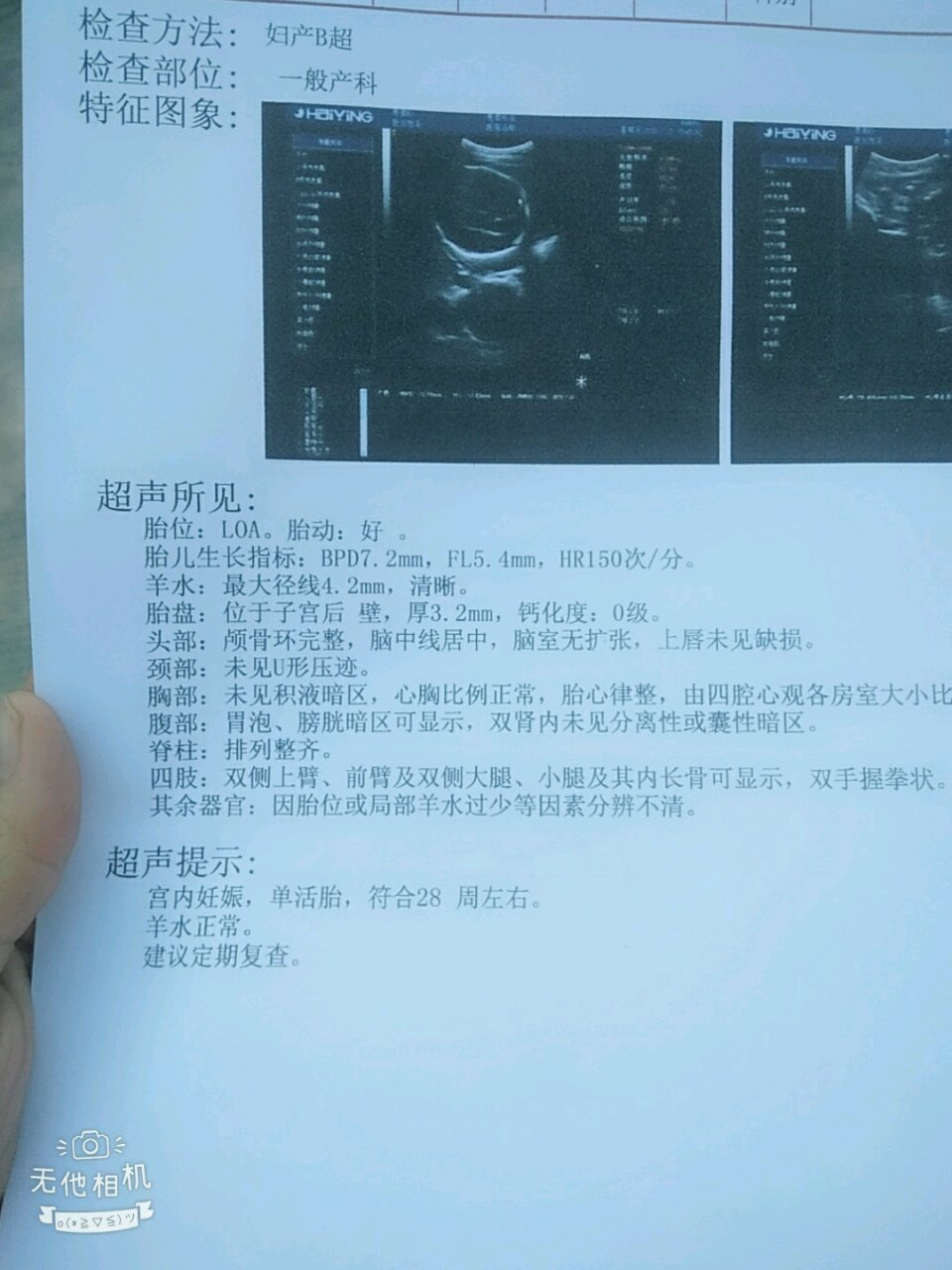 胎盘涨上去了