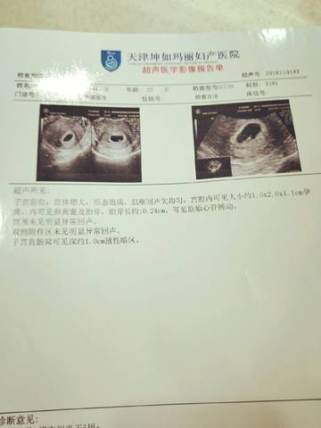 journal_insert_pic_1124699322