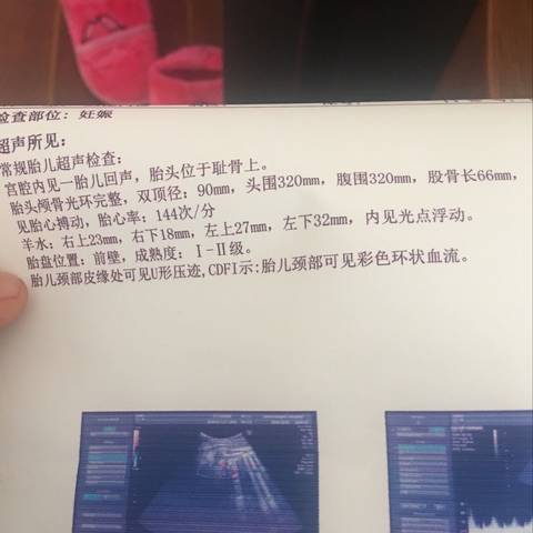 journal_insert_pic_1124510753