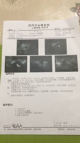 journal_insert_pic_1126269038