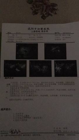 journal_insert_pic_1126262660