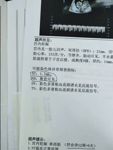 journal_insert_pic_1127315102