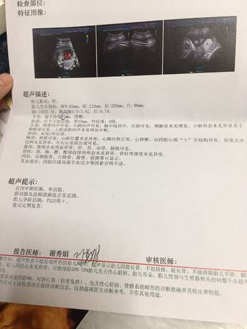 journal_insert_pic_1127781826