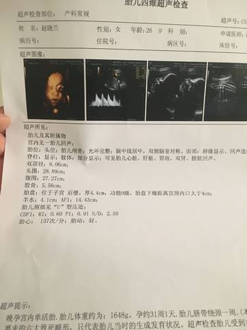 journal_insert_pic_1128127171