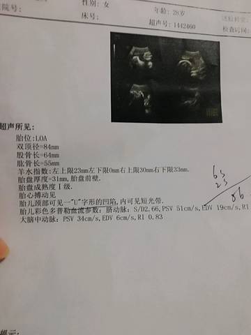 journal_insert_pic_1128980521