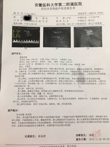 journal_insert_pic_1133331759