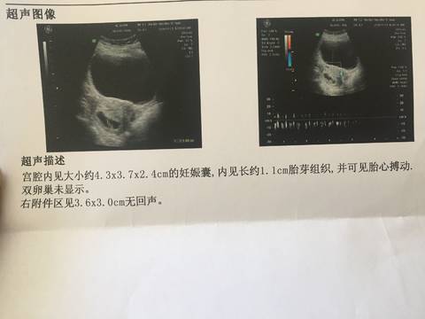 journal_insert_pic_1134072459