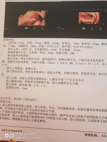journal_insert_pic_1134508634