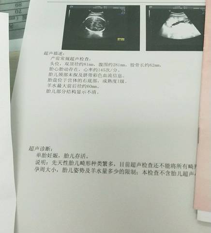 journal_insert_pic_1135239562