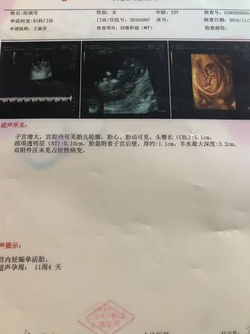 journal_insert_pic_1135167706