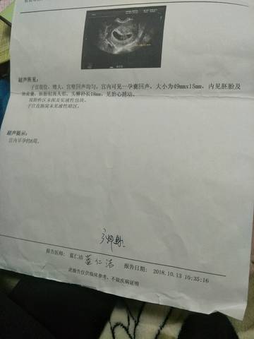 journal_insert_pic_1135536158
