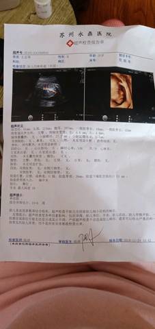 journal_insert_pic_1136271071