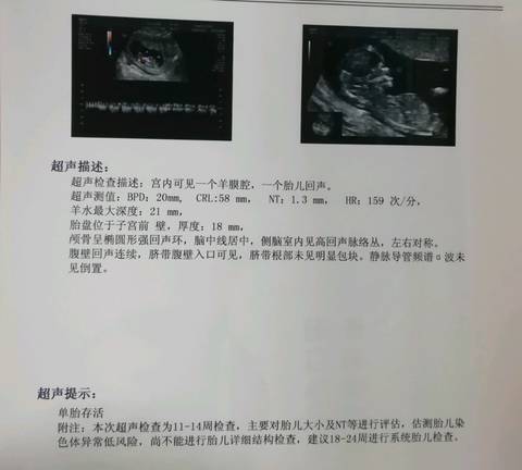journal_insert_pic_1136620821