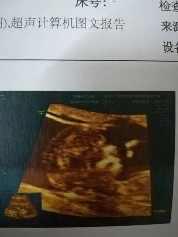 journal_insert_pic_1137677116