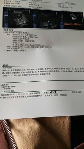 journal_insert_pic_1137415109