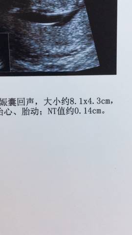 journal_insert_pic_1138804525