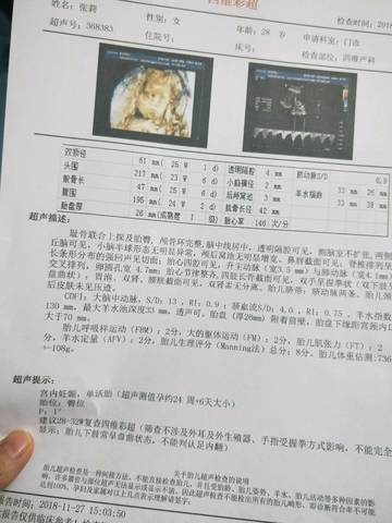 journal_insert_pic_1138853921
