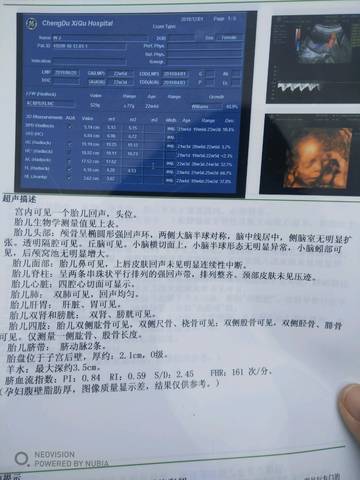 journal_insert_pic_1141273246