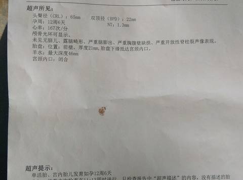 journal_insert_pic_1141265919
