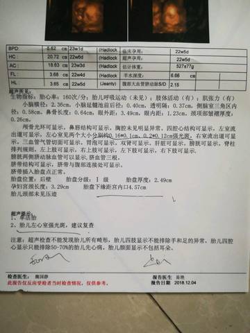 journal_insert_pic_1143155002