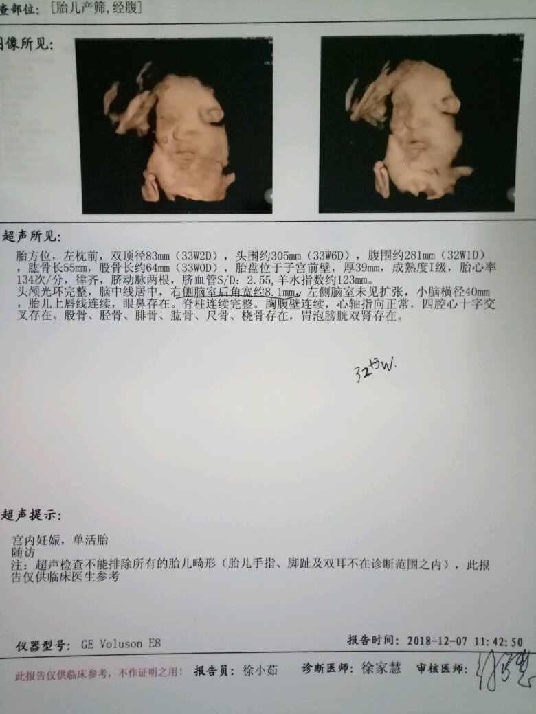 懂的宝妈帮忙看一下