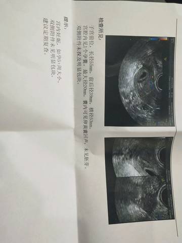 journal_insert_pic_1146943931