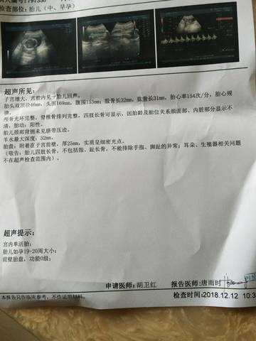journal_insert_pic_1147303938