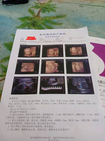 journal_insert_pic_1147220737