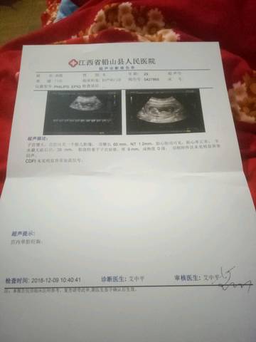 journal_insert_pic_1147178206
