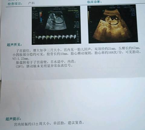 journal_insert_pic_1147908010