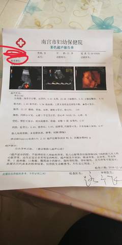 journal_insert_pic_1148329185