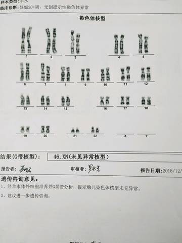 journal_insert_pic_1148617741