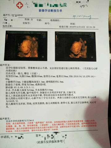 journal_insert_pic_1149835201