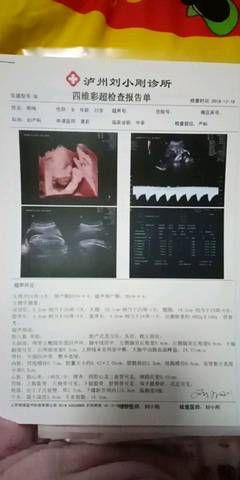 journal_insert_pic_1150694641