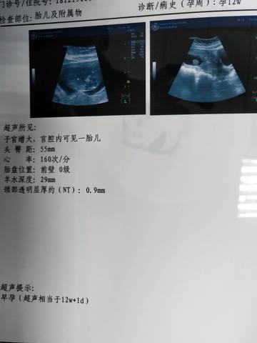 journal_insert_pic_1150844984