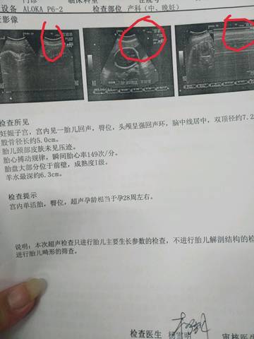 journal_insert_pic_1150704529