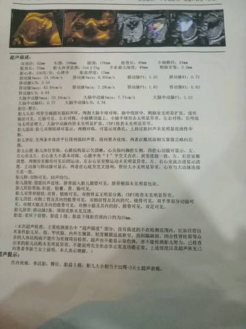 journal_insert_pic_1151267809